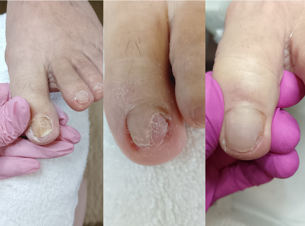 Előtte Utána Eredmény 3